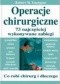 Operacje chirurgiczne. 73 najczęściej wykonywane zabiegi. Co robi chirurg i dlaczego?