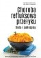 Choroba refluksowa przełyku. Dieta i jadłospisy