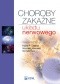Choroby zakaźne układu nerwowego