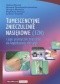 Tumescencyjne znieczulenie nasiękowe (TZN) i jego praktyczne znaczenie we współczesnej chirurgii