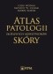 Atlas patologii złośliwych nowotworów skóry