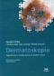 Dermatoskopia. Algorytmiczna metoda oparta na analizie wzorca
