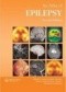 Atlas of Epilepsy