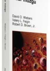 Okładka książki Udar mózgu Robert Brown, Valery L. Feigin, David O. Wiebers