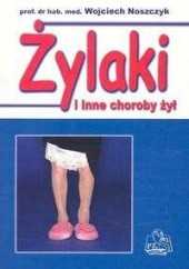 Okładka książki Żylaki i inne choroby żył Wojciech Noszczyk