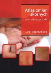 Okładka książki Atlas zmian skórnych u osób zakażonych HIV Ewa Firląg-Burkacka