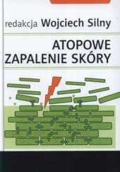 Okładka książki Atopowe zapalenie skóry Wojciech Silny