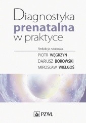 Okładka książki Diagnostyka prenatalna w praktyce Szymon Bednarek, Dariusz Borowski, Grzegorz H. Bręborowicz, Piotr Węgrzyn, Mirosław Wielgoś