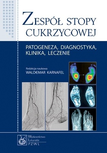 Okładka książki Zespół stopy cukrzycowej Radosław Bilski, Monika Kasprowicz, Waldemar Waldemar