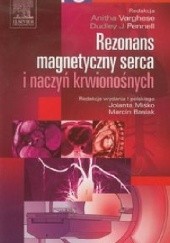 Rezonans magnetyczny serca i naczyń krwionośnych