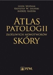 Okładka książki Atlas patologii złośliwych nowotworów skóry Andrzej Kaszuba, Leszek Woźniak, Krzysztof W. Zieliński