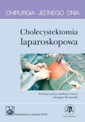 Okładka książki Cholecystektomia laparoskopowa. Chirurgia jednego dnia Grzegorz Krasowski, Doug McWhinnie, Mark Skues, Ian Smith