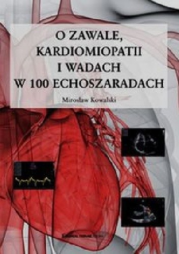 Okładka książki O zawale, kardiomiopatii i wadach w 100 echoszaradach Mirosław Kowalski