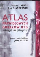 Okładka książki Atlas prawidłowych obrazów RTG imitujących stan patologiczny Mark W. Anderson, Theodore E. Keats