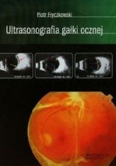 Okładka książki Ultrasonografia gałki ocznej Piotr Fryczkowski