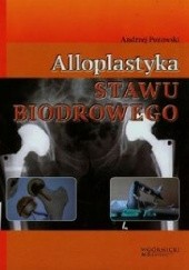 Okładka książki Alloplastyka stawu biodrowego Andrzej Pozowski