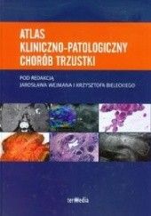 Okładka książki Atlas kliniczno - patologiczny chorób trzustki Krzysztof Bielecki (lekarz), Jarosław Wejman