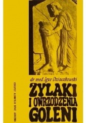 Okładka książki Żylaki i owrzodzenia goleni Igor Dziaczkowski
