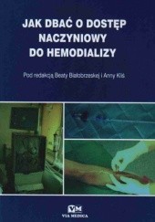 Jak dbać o dostęp naczyniowy do hemodializy