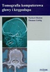 Okładka książki Tomografia Komputerowa Głowy I Kręgosłupa Norbert Hosten, Liebig Thomas Bekiesińska-Figato