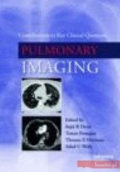 Okładka książki Pulmonary Imaging S. Desai