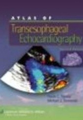 Okładka książki Atlas of Transesophageal Echocardiography N. Nanda