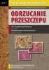 Okładka książki Transplantologia Praktyczna, Tom I. Odrzucanie Przeszczepu. I Kurs Transplantologii Praktycznej Pod Auspicjami Europejskiego Towarzystwa Transplantacyjnego (ESOT) Bartosz Foroncewicz,&nbsp;Krzysztof Mucha,&nbsp;Leszek Pączek
