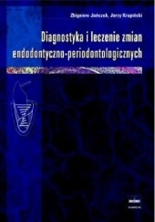 Okładka książki Diagnostyka i leczenie zmian endodontyczno-periodontologicznych Zbigniew Jańczuk, Jerzy Krupiński