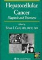 Okładka książki Hepatocellular Cancer Carr