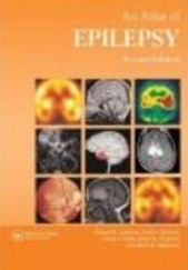 Okładka książki Atlas of Epilepsy Richard Appleton, David Chadwick, Andrew Nicolson, David Smith