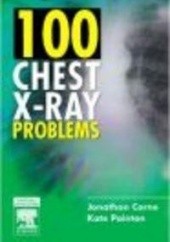 Okładka książki 100 Chest X-Ray Problems J. Corne