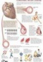Okładka książki Coronary Artery Disease Chart F. Netter