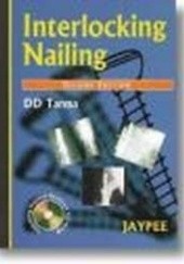 Okładka książki Interlocking Nailing 2E D. D. Tanna