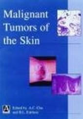 Okładka książki Malignant Tumors of Skin A. Chu