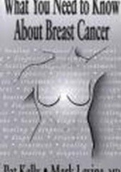 Okładka książki What You Need to Know About Breast Cancer Patrick J. Kelly