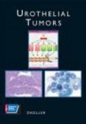 Okładka książki Urothelial Tumors M. Droller
