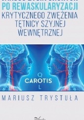 Okładka książki Jakość życia chorych po rewaskularyzacji krytycznego zwężenia tętnicy szyjnej wewnętrznej Mariusz Trystuła