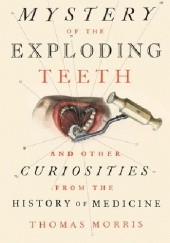 Okładka książki The Mystery of the Exploding Teeth: And Other Curiosities from the History of Medicine Thomas Morris