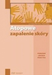 Okładka książki Atopowe zapalenie skóry. Poradnik lekarza praktyka Roman Nowicki