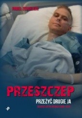 Okładka książki Przeszczep Paweł Zegarlicki