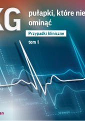 Okładka książki Pułapki EKG, które niełatwo ominąć część I Bartosz Szafran