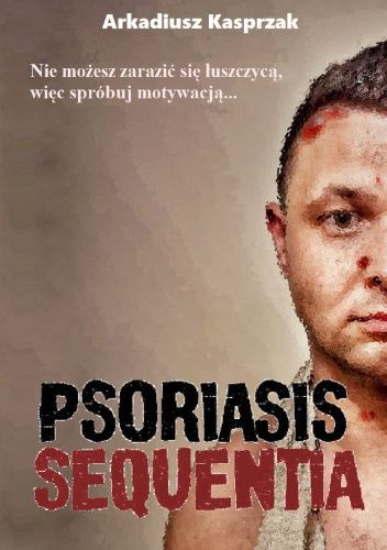 Psoriasis Sequentia