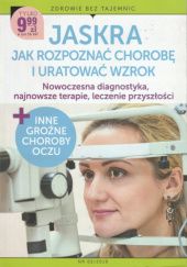 Okładka książki Jaskra : jak rozpoznać chorobę i uratować wzrok + inne groźne choroby oczu : nowoczesna diagnostyka, najnowsze terapie, leczenie przyszłości Agnieszka Fedorczyk