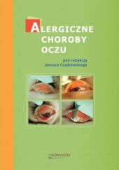 Okładka książki Alergiczne choroby oczu Ewa Bogacka, Janusz Czajkowski, Józef Małolepszy