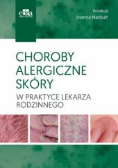 Okładka książki Choroby alergiczne skóry w praktyce lekarza rodzinnego Joanna Narbutt