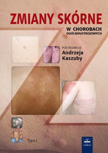 Okładki książek z cyklu Zmiany skórne w chorobach ogólnoustrojowych