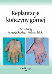 Okładka książki Replantacje kończyny górnej Jerzy Jabłecki, Andrzej Żyluk