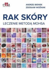 Okładka książki Rak skóry. Leczenie metodą Mohsa Andrzej Bieniek, Zdzisław Woźniak