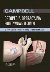 Ortopedia operacyjna. Podstawowe techniki