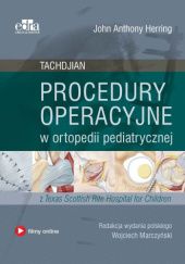 Procedury operacyjne w ortopedii pediatrycznej